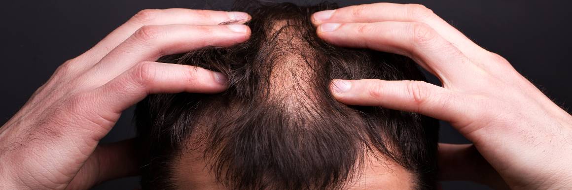 Naprawa uszkodzonych mieszków włosowych dla zdrowego wzrostu włosów