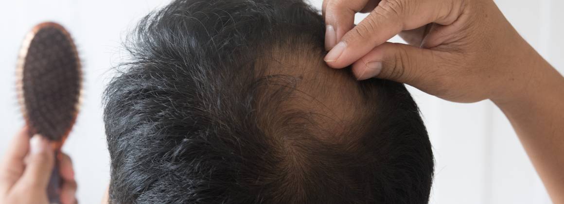 Odrastanie przerzedzonych włosów: Przyczyny, objawy i leczenie wypadania i odrastania włosów